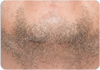 Подбородок и шея