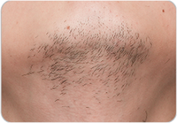 Подбородок и шея